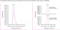 Homocysteine in Plasma / Serum / Dried Blood Spots